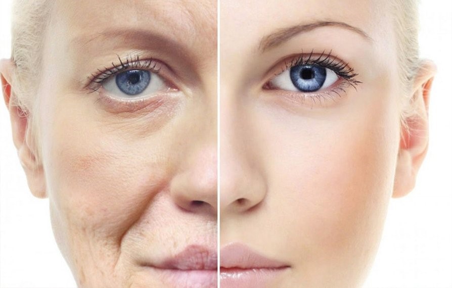 Kırışıklıkları önlüyor! Yaşlanmaya karşı altın değerinde tavsiye